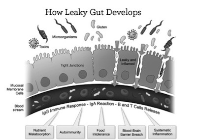 leaky-gut