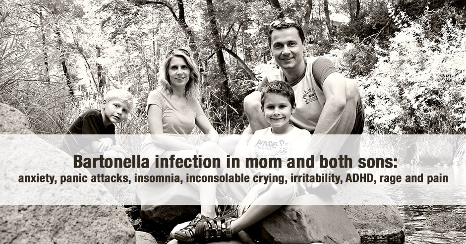 bartonella infection